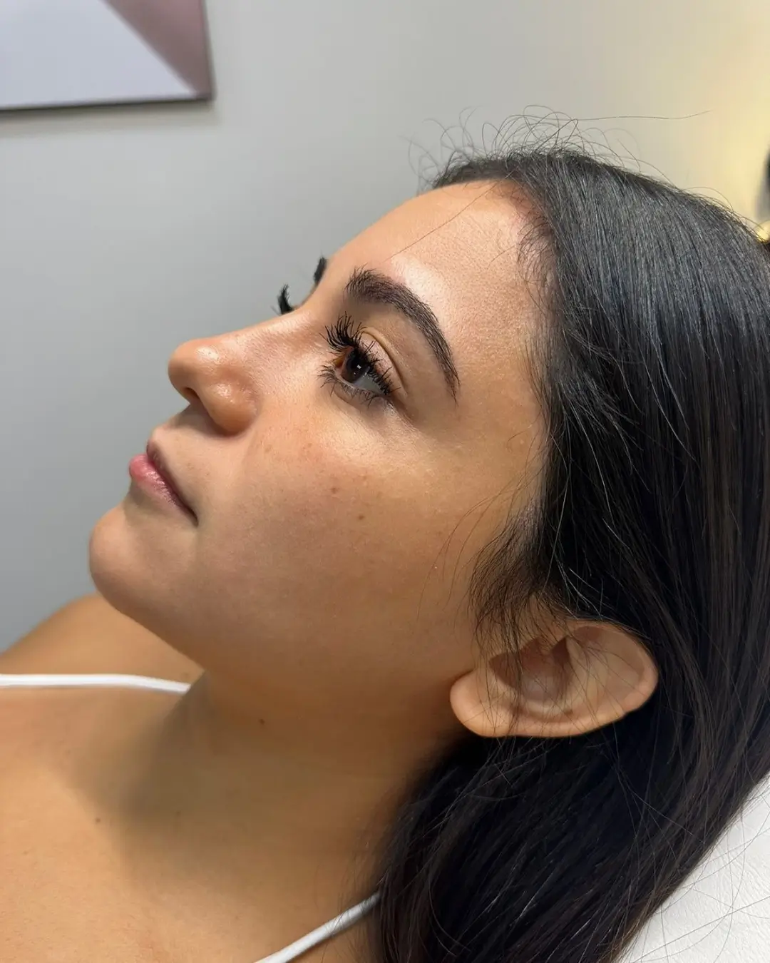 Antes del facial premium con hidrodermoabrasión — Pura Estética Cancún